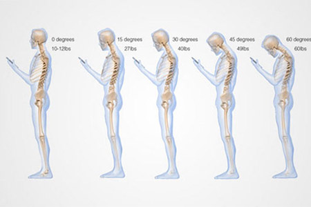 تاثیر تلفن همراه بروی ستون فقرات